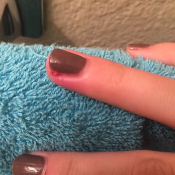Cozy Nails & Spa - Infection from ingrown nail from bad manicure. - Nail Salons Near Me - Tigard, Oregon Cozy Nails & Spa - Infection from ingrown nail from bad manicure. - Nail Salons Near Me - Tigard, Oregon
