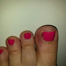 My infected toe after a pedicure here. My infected toe after a pedicure here.