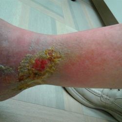 The Podiatry Clinic, PA