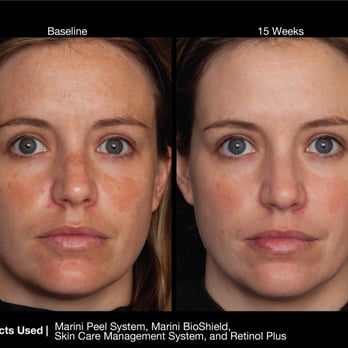 Divine Skin - Skin Care Near Me - Newport Beach, California Divine Skin - Skin Care Near Me - Newport Beach, California