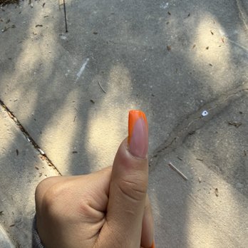 Euro Nails & Spa - Fungus infected thumb - Nail Salons Near Me - Kissimmee, Florida