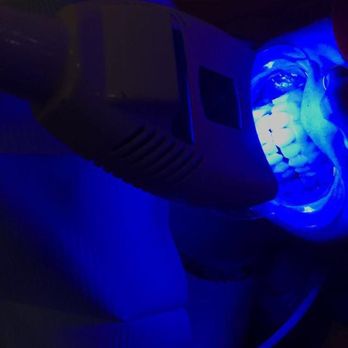 Vida Spa - What we do for beauty. Laser teeth whitening - Medical Spas Near Me - Las Vegas, Nevada