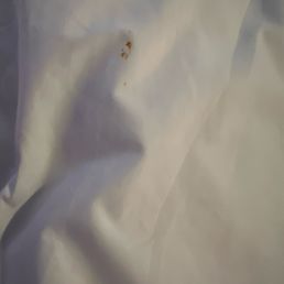 Dried blood stain on the duvet Dried blood stain on the duvet