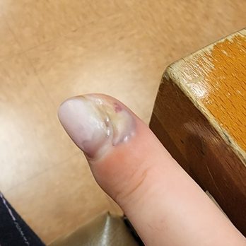 Nail Nation Studio - Today as I'm sitting in the emergency room after getting my nails done at this place - Nail Salons Near Me - Burbank, California Nail Nation Studio - Today as I'm sitting in the emergency room after getting my nails done at this place - Nail Salons Near Me - Burbank, California