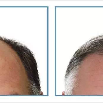 Herbert S Feinberg, MD - Dermatologists Near Me - Englewood, New Jersey Herbert S Feinberg, MD - Dermatologists Near Me - Englewood, New Jersey