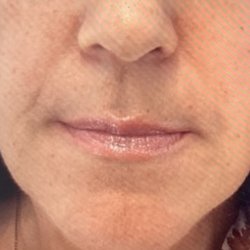 Evolution Dermatology + Wellness - Before