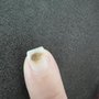 ST Nail Spa