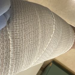Torrance Memorial Urgent Care - Torrance - Here is the end result to a pulled calve strain