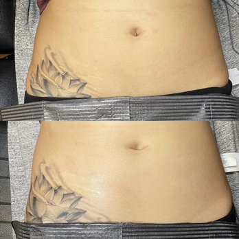 Glam Esthetics - Before and after - Permanent Makeup Near Me - Maple Valley, Washington Glam Esthetics - Before and after - Permanent Makeup Near Me - Maple Valley, Washington
