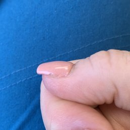 Sides of acrylic is not smooth. And gel starting to lift