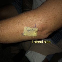 George Kardashian, M.D. - Lateral side
