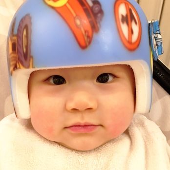 Stellar Prosthetics & Orthotics - When my son first got his helmet from Stellar Prosthetics & Orthotics - Orthotics Near Me - Pasadena, California Stellar Prosthetics & Orthotics - When my son first got his helmet from Stellar Prosthetics & Orthotics - Orthotics Near Me - Pasadena, California