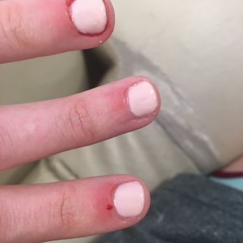 Envy Nail Spa - Quaint little blood border around my ring finger - Nail Salons Near Me - Auburn, Alabama Envy Nail Spa - Quaint little blood border around my ring finger - Nail Salons Near Me - Auburn, Alabama