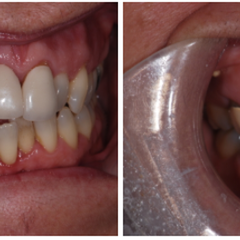 Jeffrey S Cummings, DMD - General Dentistry Near Me - Waltham, Massachusetts