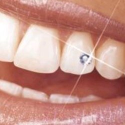 Swarovski Tooth Gem