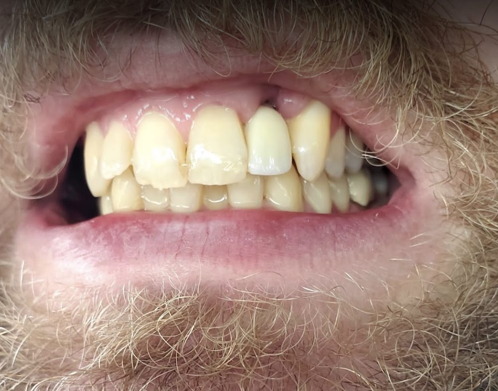 PRO DENTAL CARE Updated August 2024 68 Photos & 53 Reviews 300