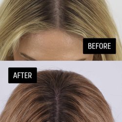YAKER Hair Restoration + Med Spa