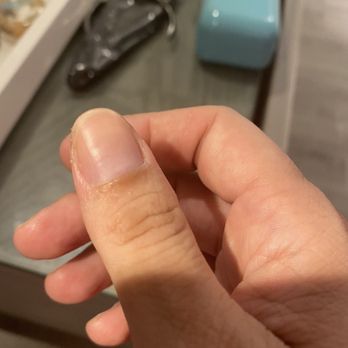 Paloma Nails - Traumatized and painful badly cut cuticles and sides - Nail Salons Near Me - Houston, Texas Paloma Nails - Traumatized and painful badly cut cuticles and sides - Nail Salons Near Me - Houston, Texas