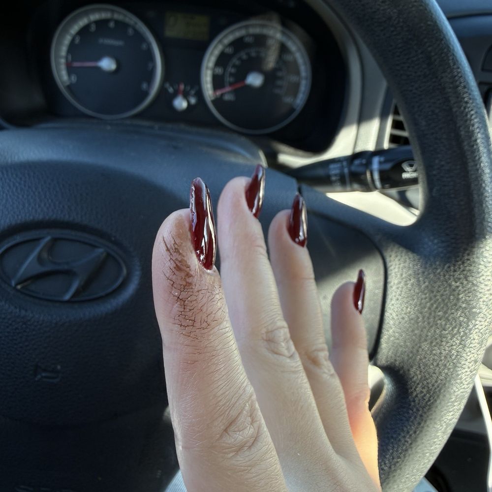Luster Nail & Spa - Nail infection :( - Nail Salons Near Me - Scottsdale, Arizona Luster Nail & Spa - Nail infection :( - Nail Salons Near Me - Scottsdale, Arizona