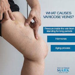 Mark Medical Care Vein & Fibroids