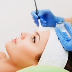 Chemical Peel