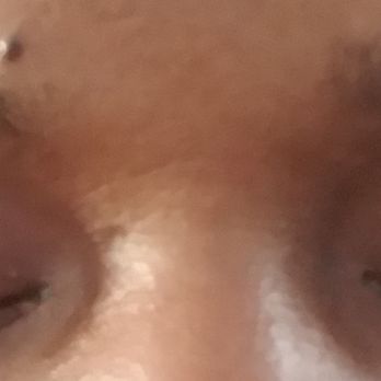 Sunshine Eyebrows Threading - Lashes fell out from itchyness 4 days later after lids glued together - Eyebrow Services Near Me - Nesconset, New York