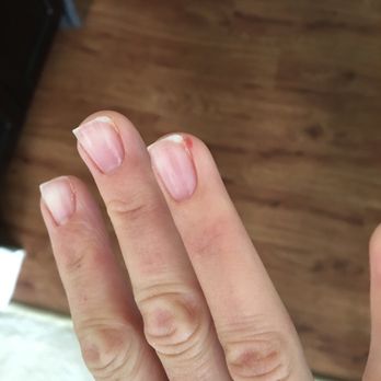 29 Nail & Spa - Man who cut me and didn't use antiseptic.  Gross! - Nail Salons Near Me - Patchogue, New York