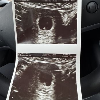 Peek A Boo - My little bean. Got to see the heart fluttering - Ultrasound Imaging Centers Near Me - Hesperia, California Peek A Boo - My little bean. Got to see the heart fluttering - Ultrasound Imaging Centers Near Me - Hesperia, California