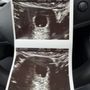 Photo of Peek A Boo