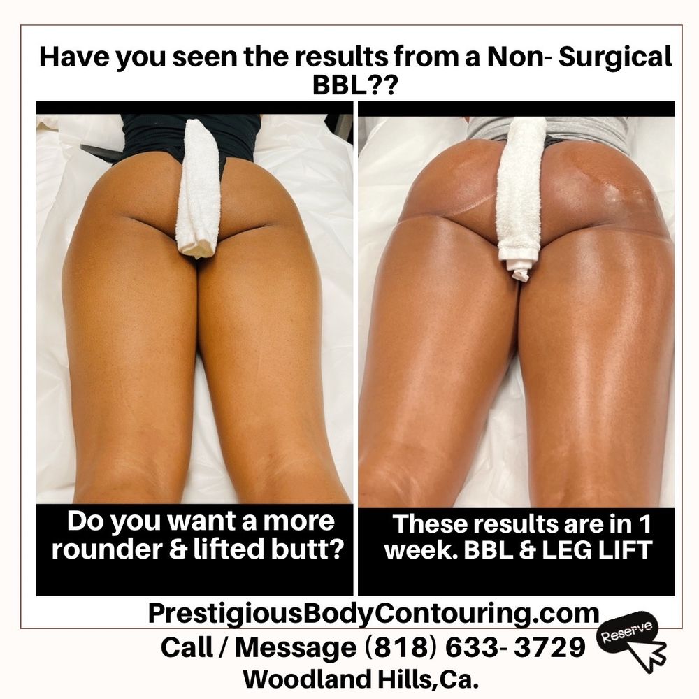 Prestigious Body Contouring Logo