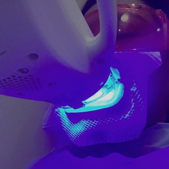 Seapoint Clinic - Zoom teeth whitening in action! - Cosmetic Dentists Near Me - Blackrock, D