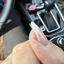 A D Nail