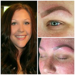 Left: Before Right Top: 1 hour after procedure Right Bottom: seconds after procedure