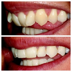 Robinson Township Smiles