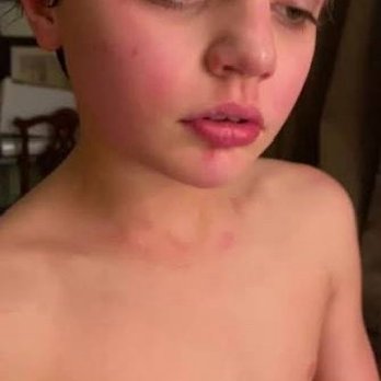 Great Wolf Lodge - Manteca - sick kid just like what happened to me last year - Resorts Near Me - Manteca, California