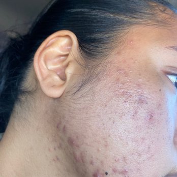 Pure Skin by Maggie - Skin Care Near Me - Honolulu, Hawaii