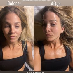 The best facial! So relaxing and my skin looks incredible - I asked for skin tighteningexfoliation brightening
