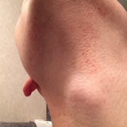 DC Barber - 12 hours later
