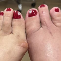 Richard R Moy, DPM - 1st Post op Pedicure see you for the the left foot for ASAP