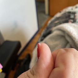 Avalon Institute - The polish is coming off my nail.