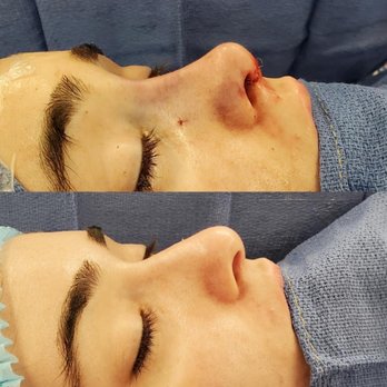 Moustafa Mourad, MD - Plastic Surgeons Near Me - New York, New York Moustafa Mourad, MD - Plastic Surgeons Near Me - New York, New York