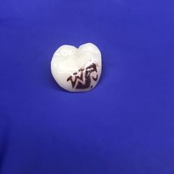 WSU Cougar crowned tooth.  Go Cougs!!!