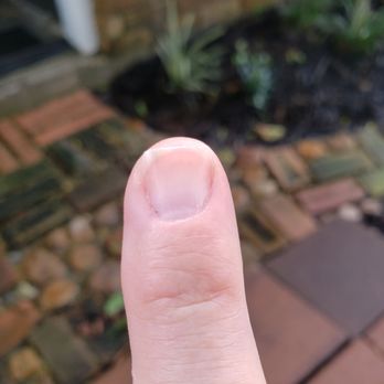 Anthony Vince' Nail Spa - UNGLOVED thumb on top of it to wipe away bleeding cuticle. UNEVEN cut/shaped nails - Nail Salons Near Me - Pearland, Texas Anthony Vince' Nail Spa - UNGLOVED thumb on top of it to wipe away bleeding cuticle. UNEVEN cut/shaped nails - Nail Salons Near Me - Pearland, Texas