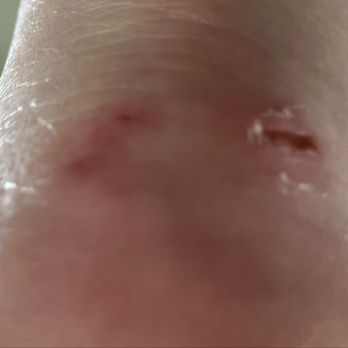 Prive Nail Lounge - Achilles heel, awful pedicure! - Nail Salons Near Me - Riverview, Florida Prive Nail Lounge - Achilles heel, awful pedicure! - Nail Salons Near Me - Riverview, Florida