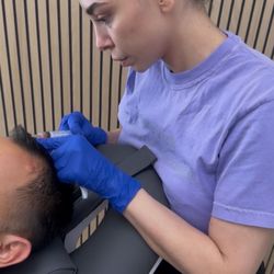 Hair PRP & Microneedling