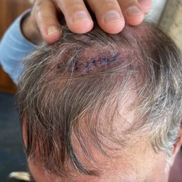 Dr. Burris' good work!