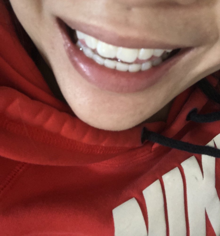 APEX FAMILY DENTAL PC Updated August 2024 22 Photos & 39 Reviews