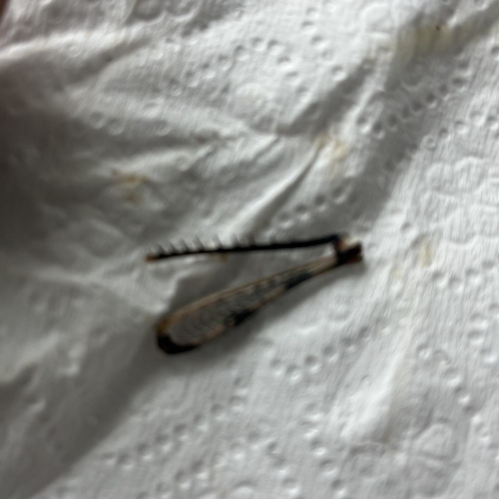 Zaxbys - Bug leg in salad - Fast Food Near Me - Jacksonville, Florida Zaxbys - Bug leg in salad - Fast Food Near Me - Jacksonville, Florida