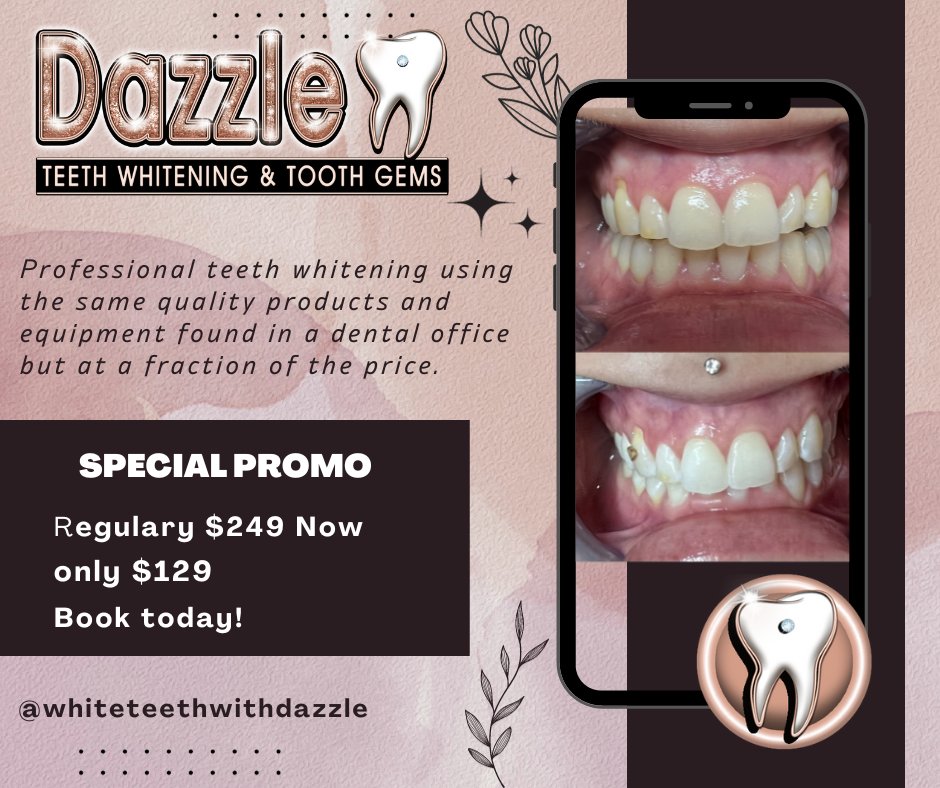 DAZZLE TEETH WHITENING & TOOTH GEMS Request an Appointment 2580 AZ