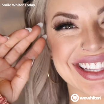 We Whiten - Teeth Whitening Near Me - Farmington, Utah We Whiten - Teeth Whitening Near Me - Farmington, Utah